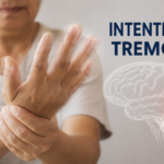 intention tremor